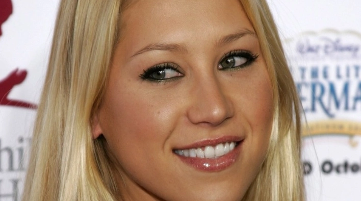 Anna Kournikova's Teeth in the 2020s