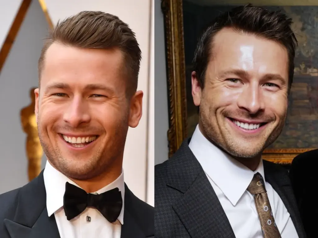 glen powell hambad enne ja pärast