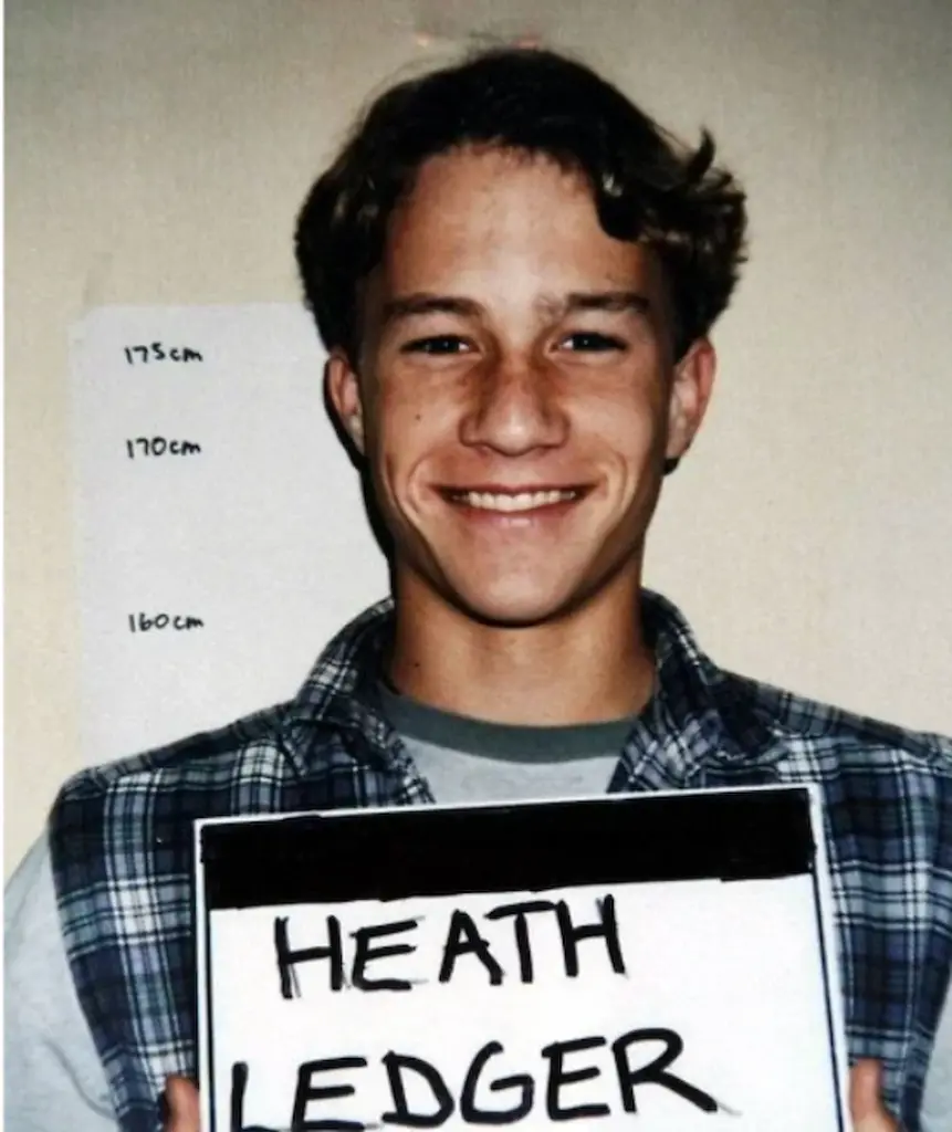 heath ledger teeth 2010