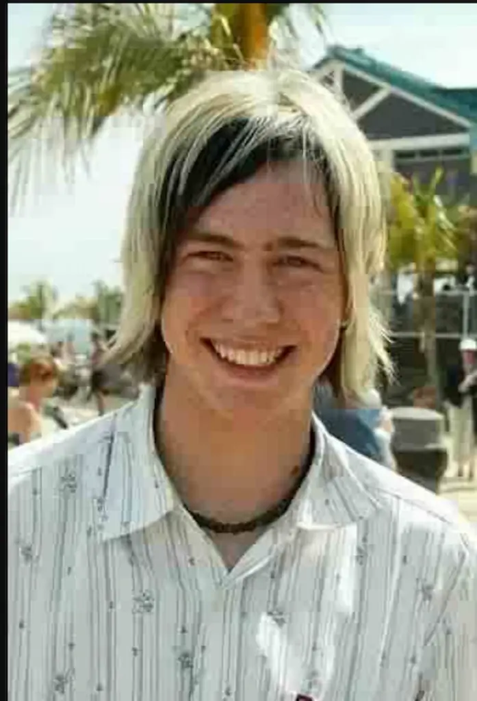 أسنان James bourne في عام 2000