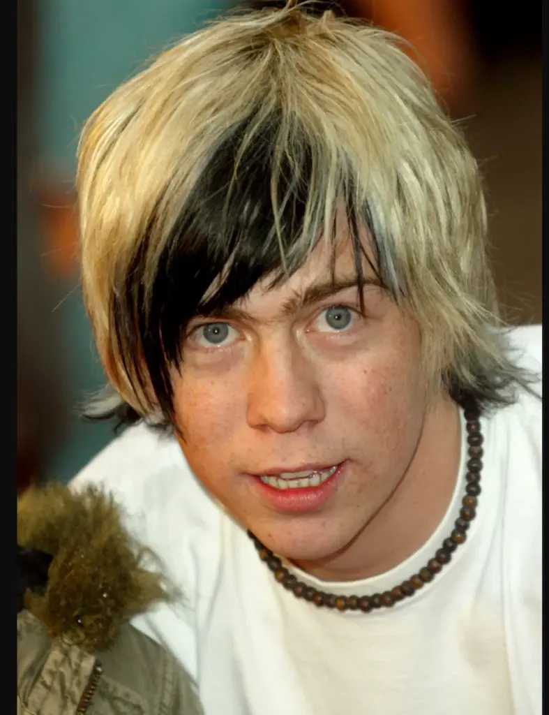 أسنان James bourne في عام 2010