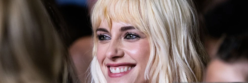 dientes de kristen stewart en 2025