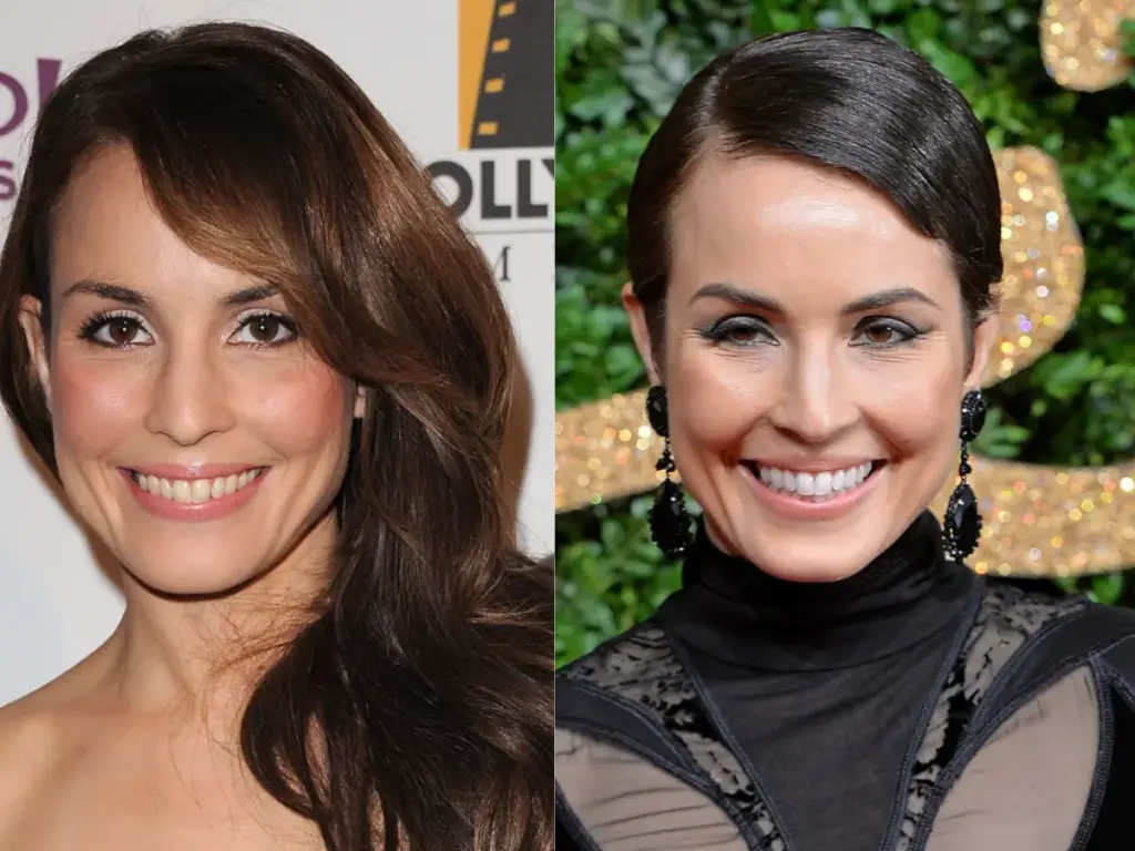 noomi rapace dientes antes y después