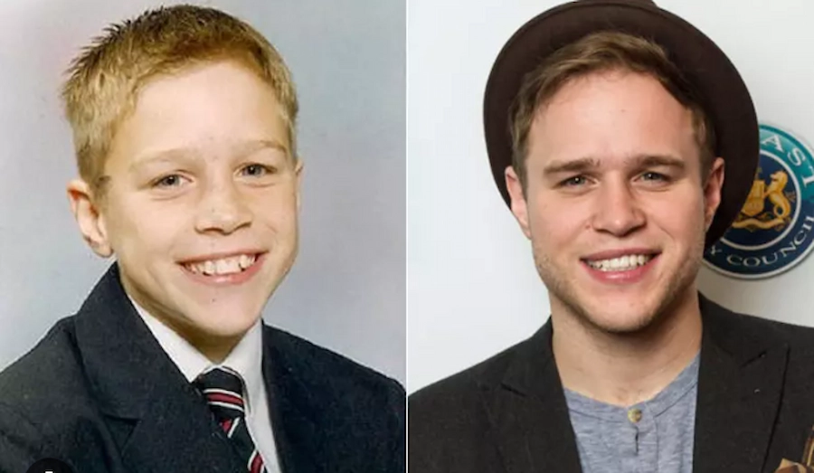olly murs teeth 2015