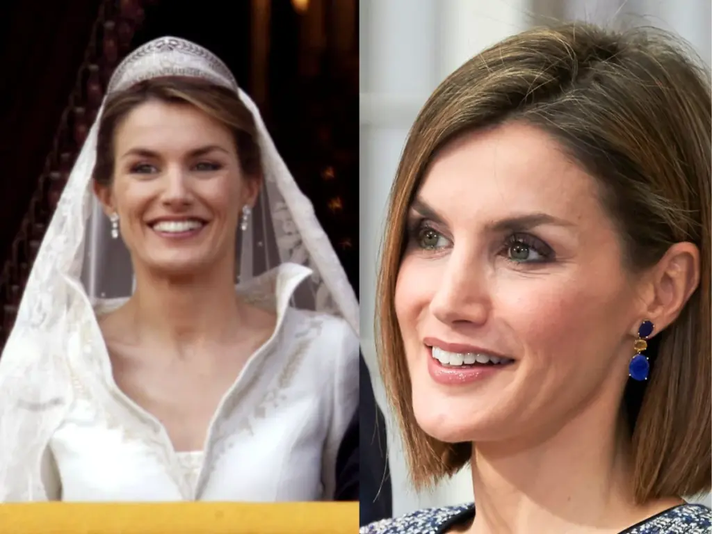 queen letizia teeth before after