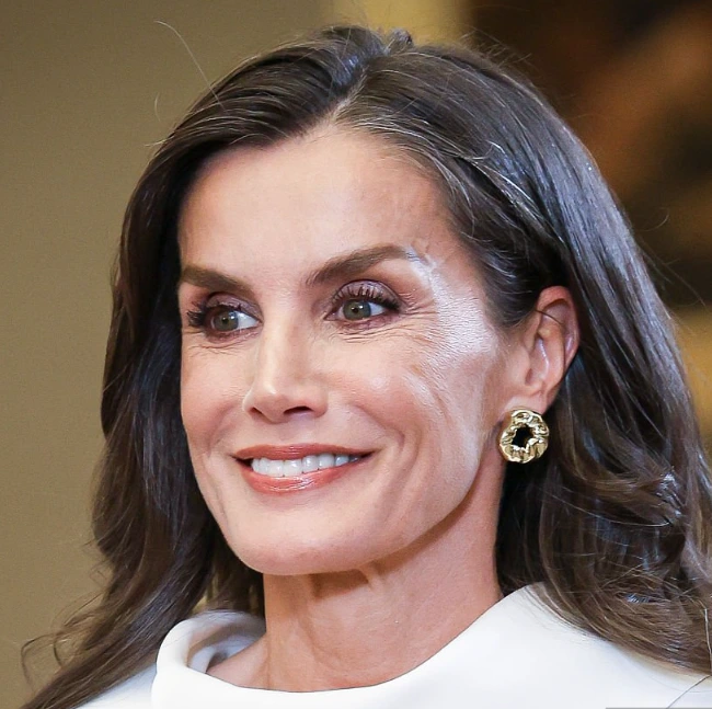 queen letizia teeth in 2025