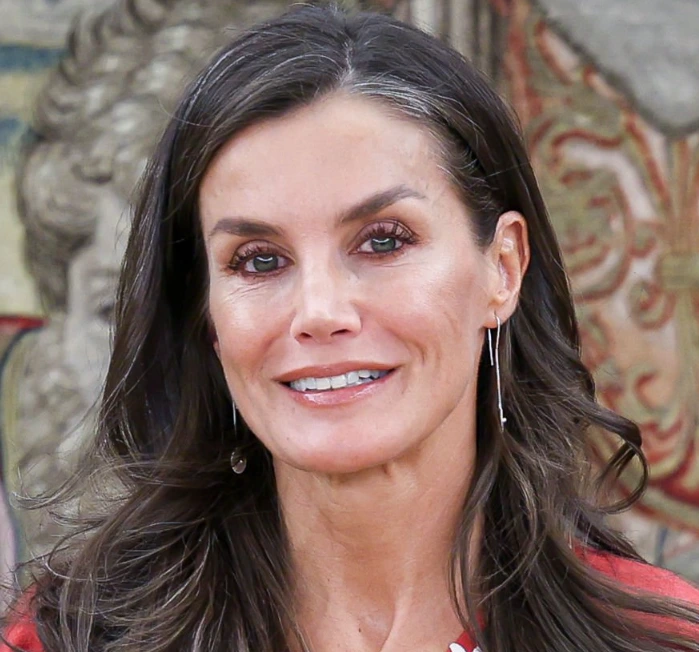 queen letizia teeth
