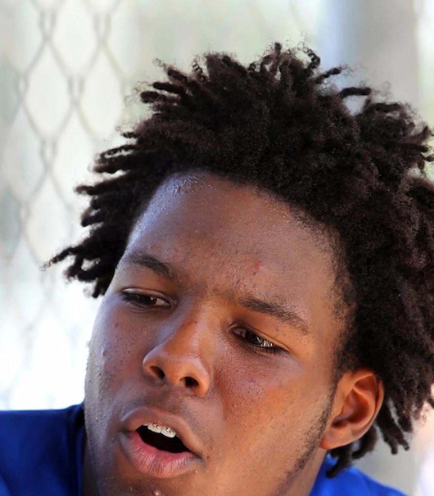 أسنان فلاديمير غوارديولا جونيور في 2015