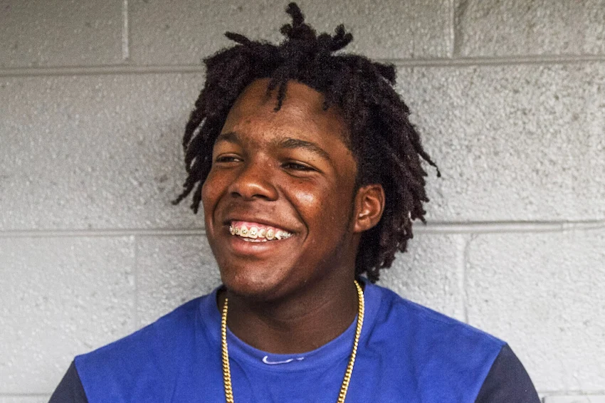 أسنان فلاديمير غوارديولا جونيور في 2017