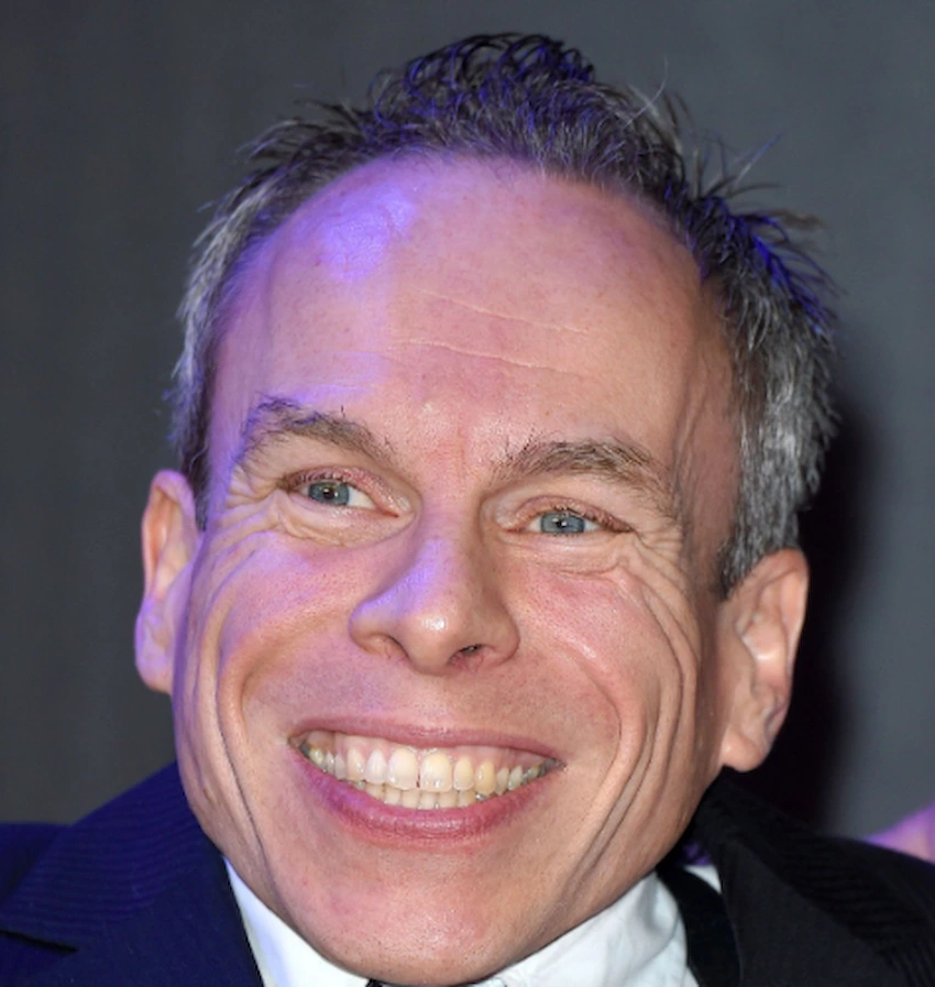 warwick davis teeth 2015
