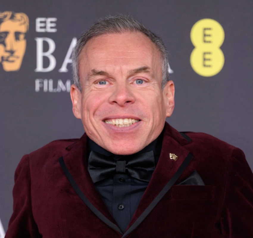 warwick davis teeth 2025