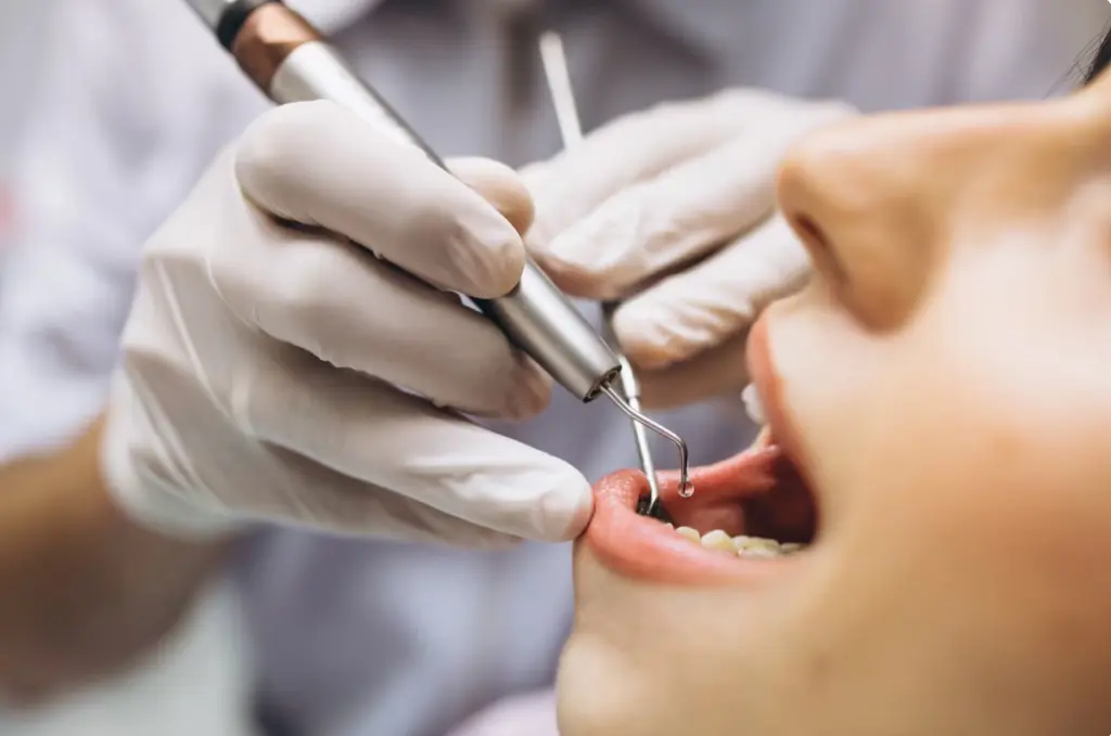 cod-dentar-d0120