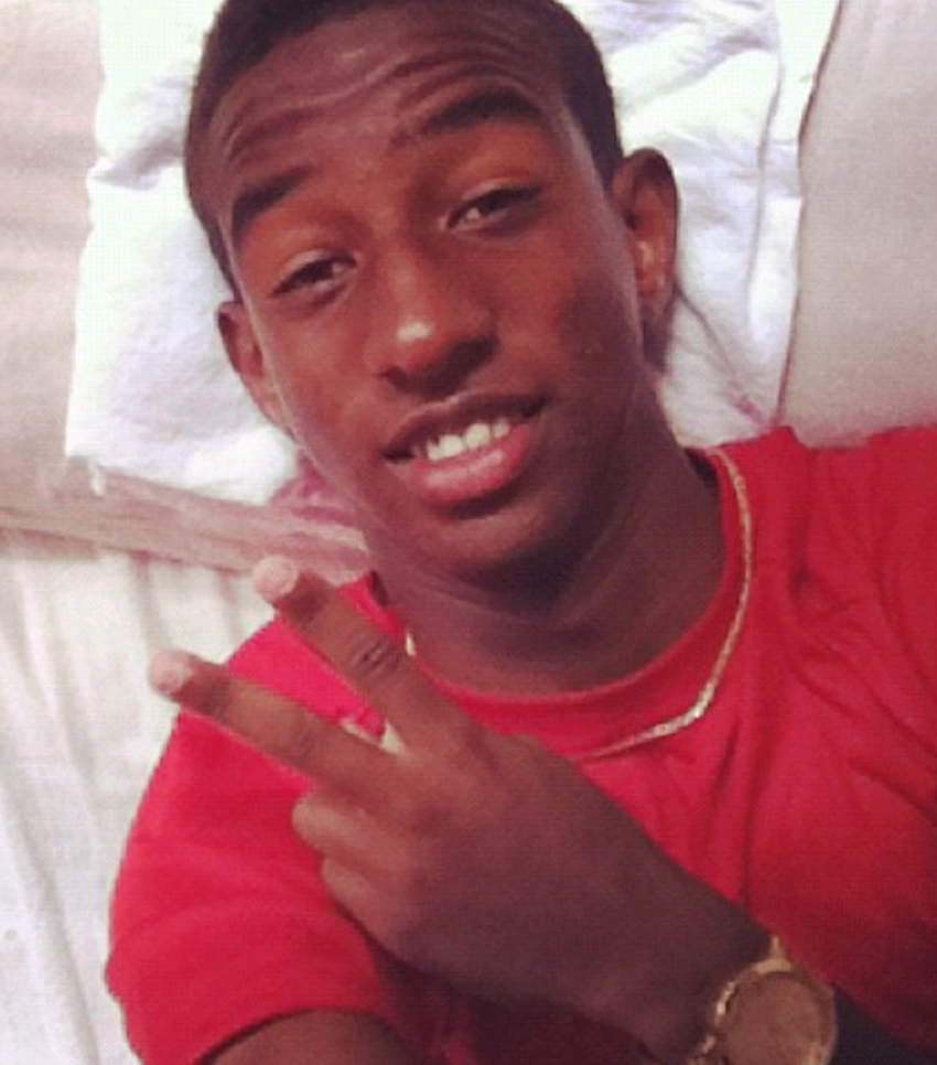 anderson talisca teeth 2012