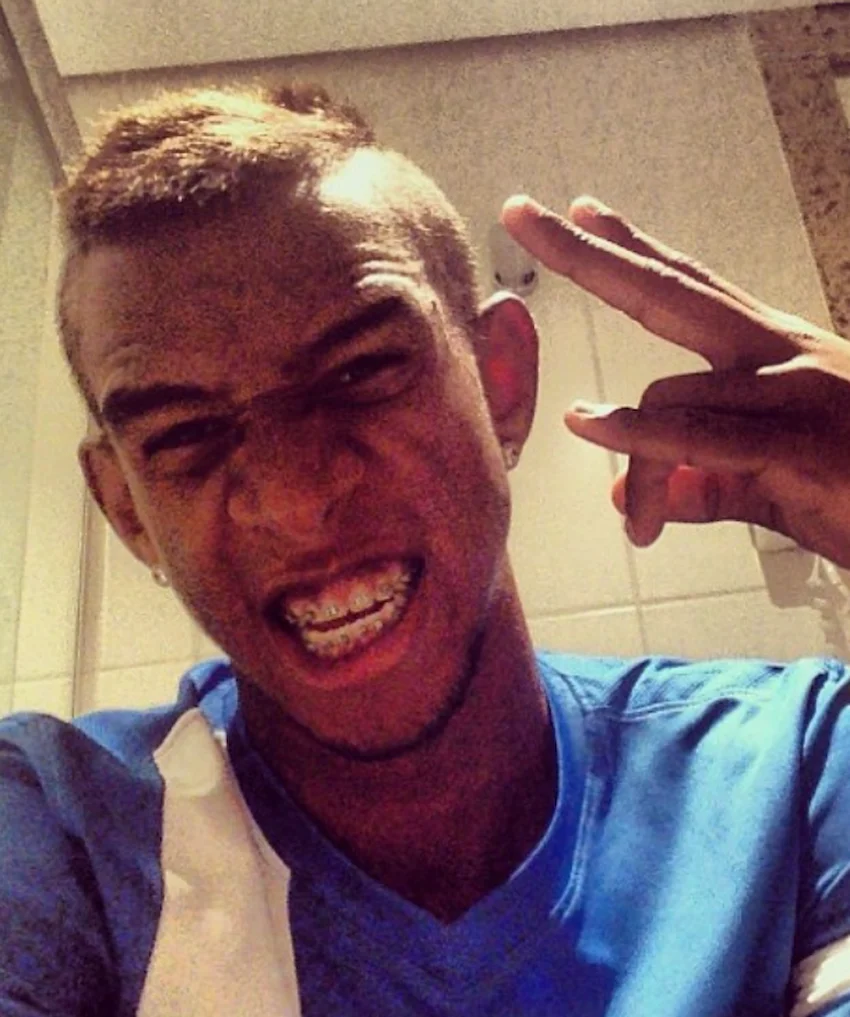anderson talisca teeth 2013