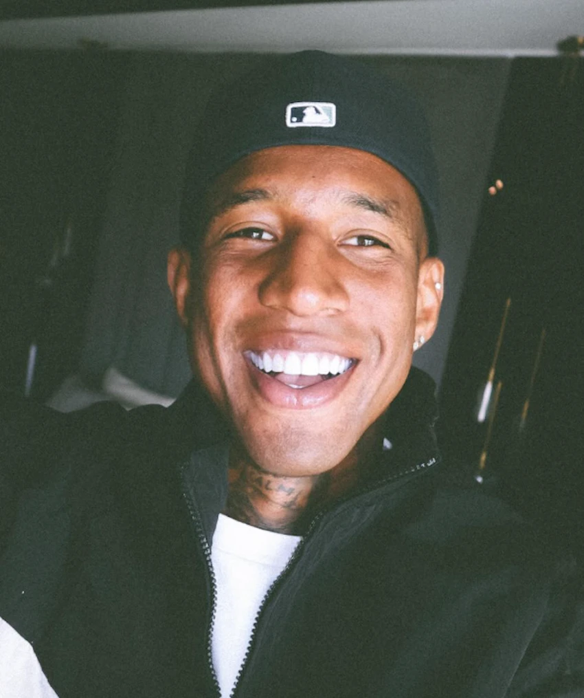 anderson talisca teeth 2025