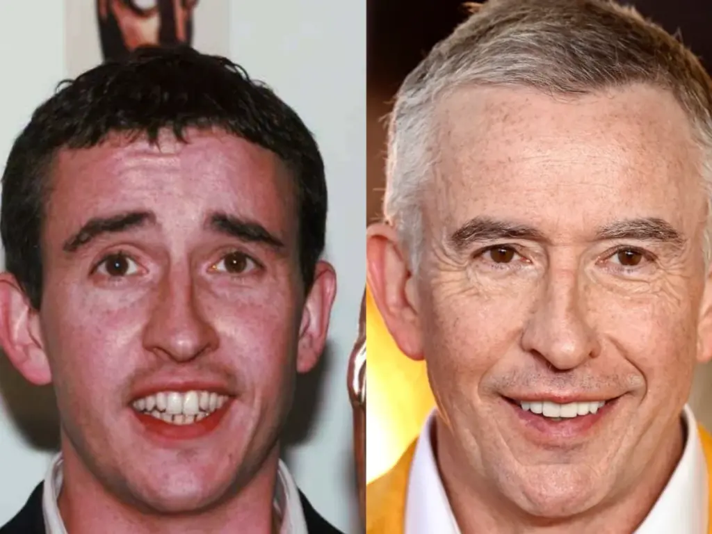 steve coogan teeth before after