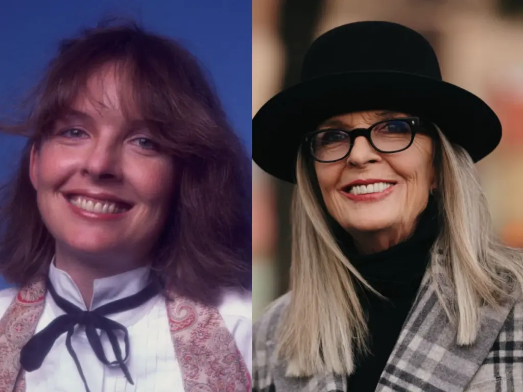 diane keaton teeth before after