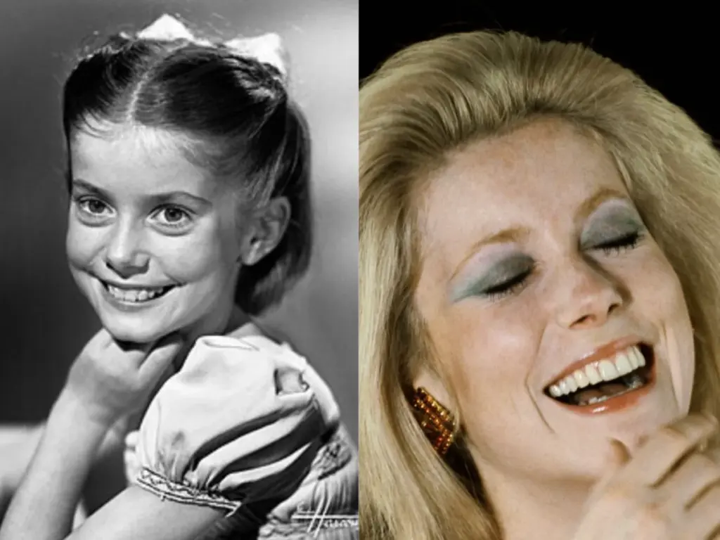 antes y después de los dientes de Catherine Deneuve