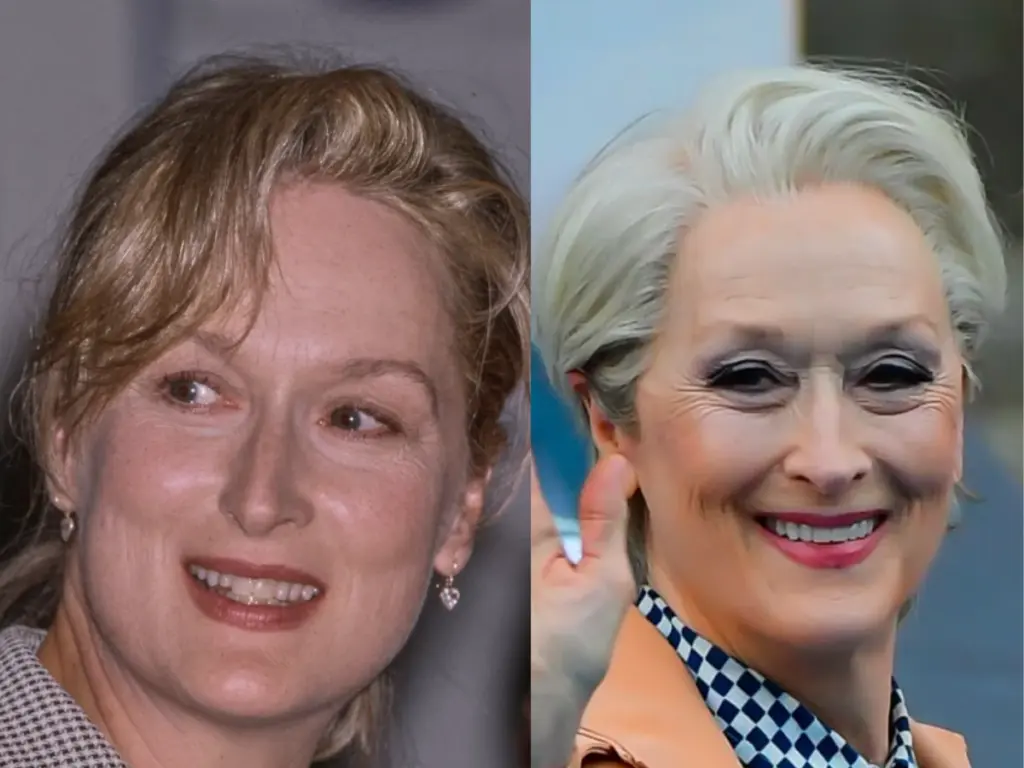 meryl streep teeth before after