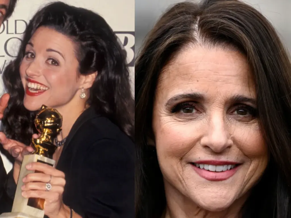 julia louis dreyfus zähne vor nachher