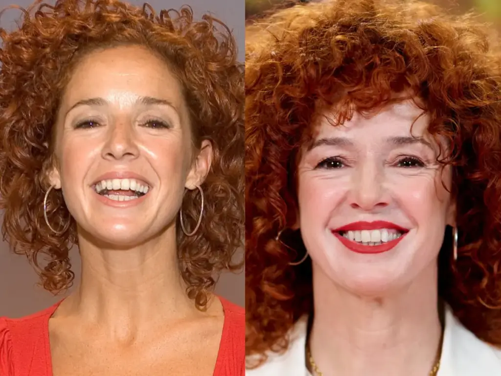 marta-belenguer-teeth-before-after