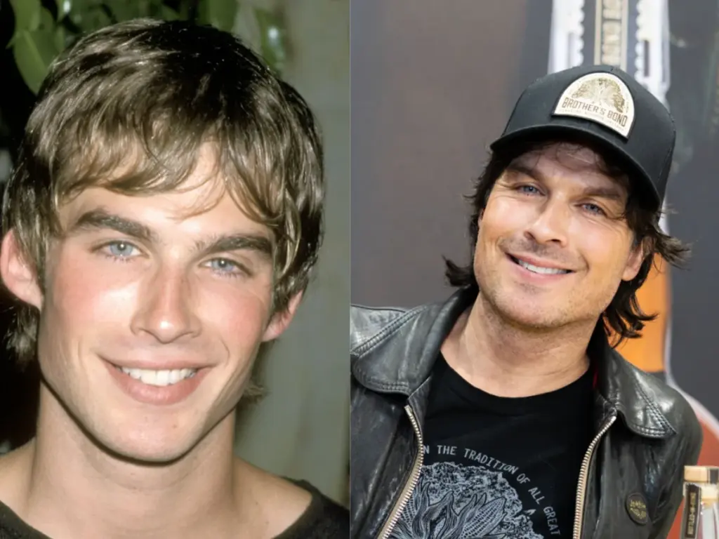 ian-somerhalder-teeth-before-after
