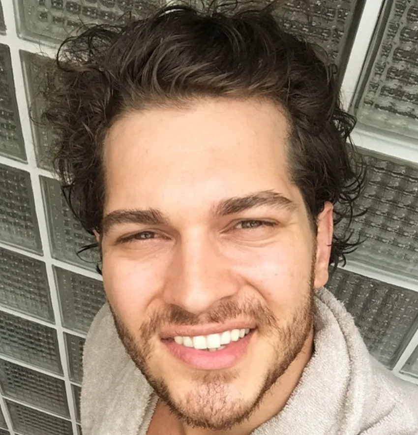 cagatay ulusoy teeth 2015