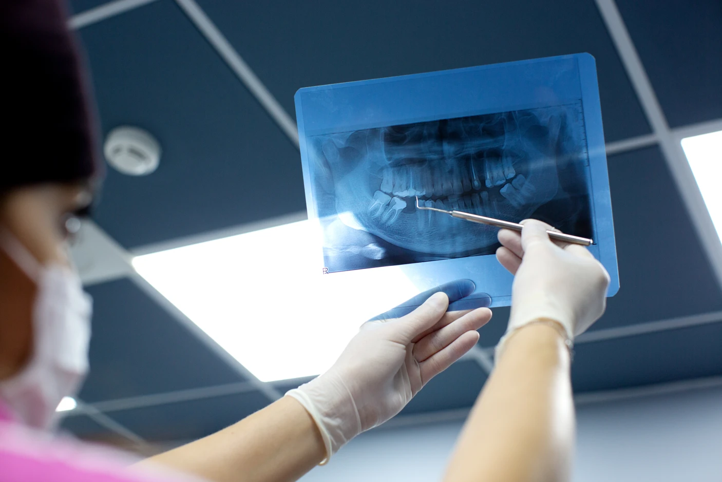 can dental x ray cause cancer