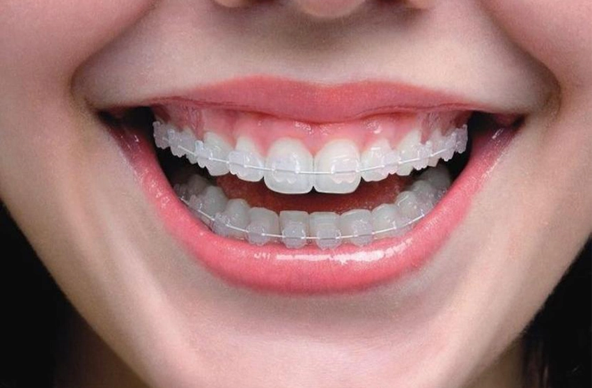 ¿Se pueden enderezar los dientes a cualquier edad?