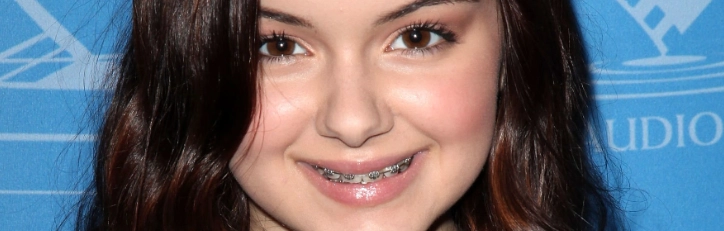 تقويم الأسنان للمراهقين