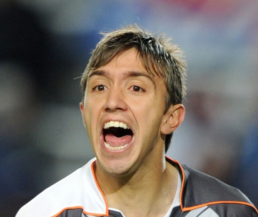 fernando muslera teeth 2010