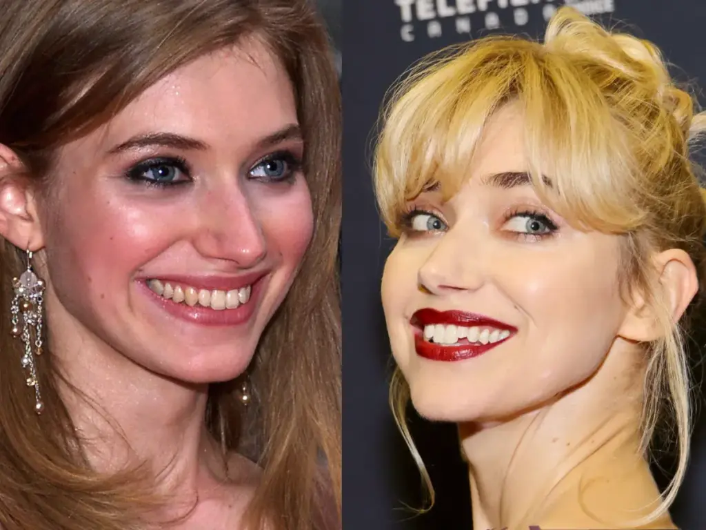 зуби Імоджен Поутс до і після