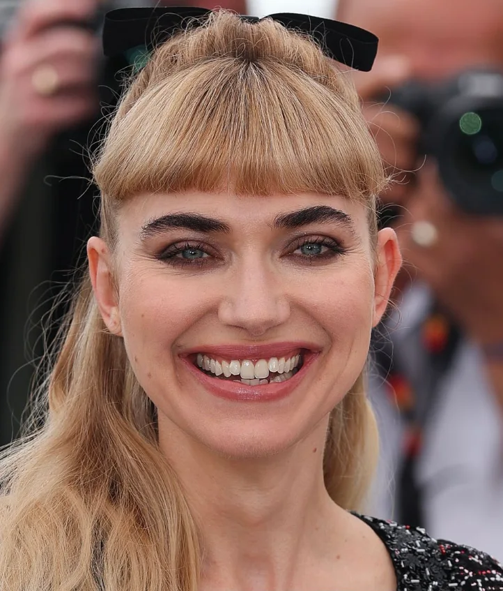 зуби Імоджен Поутс у 2025