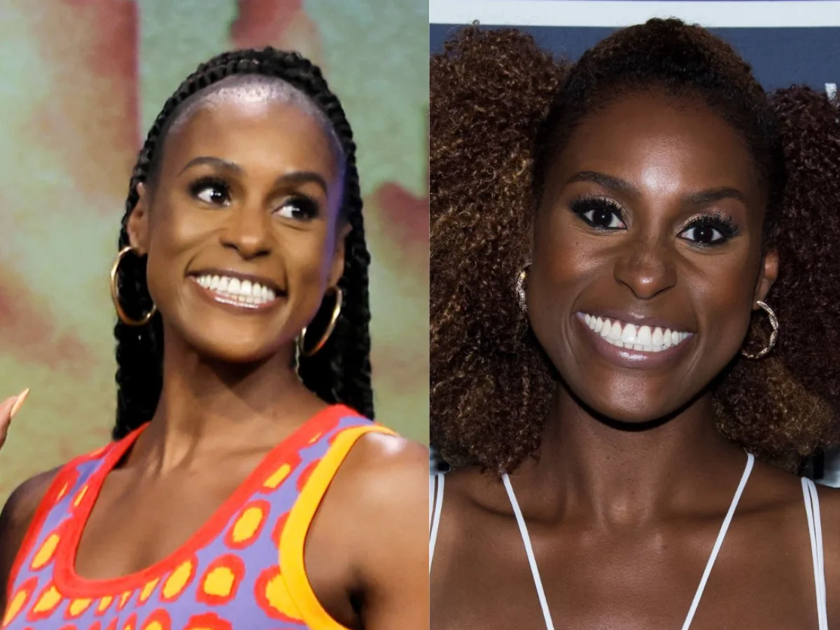 issa rae teeth before after
