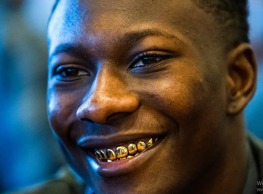 marquise hollywood brown teeth 2019