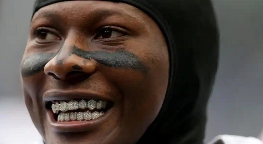 marquise hollywood brown teeth 2023