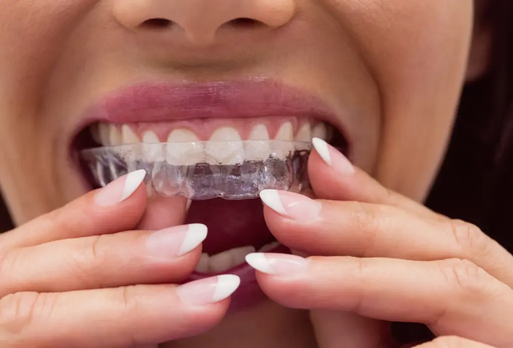 mouth guard for sleep apnea therapy