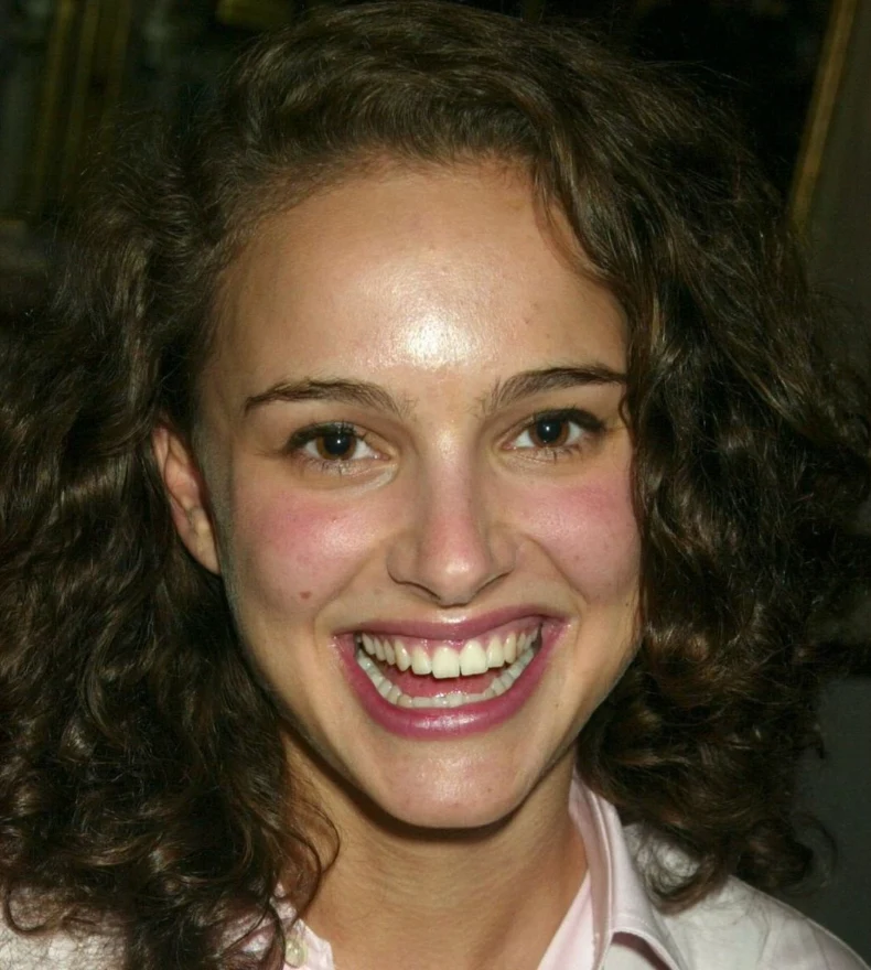 зубы натали портман в 2003