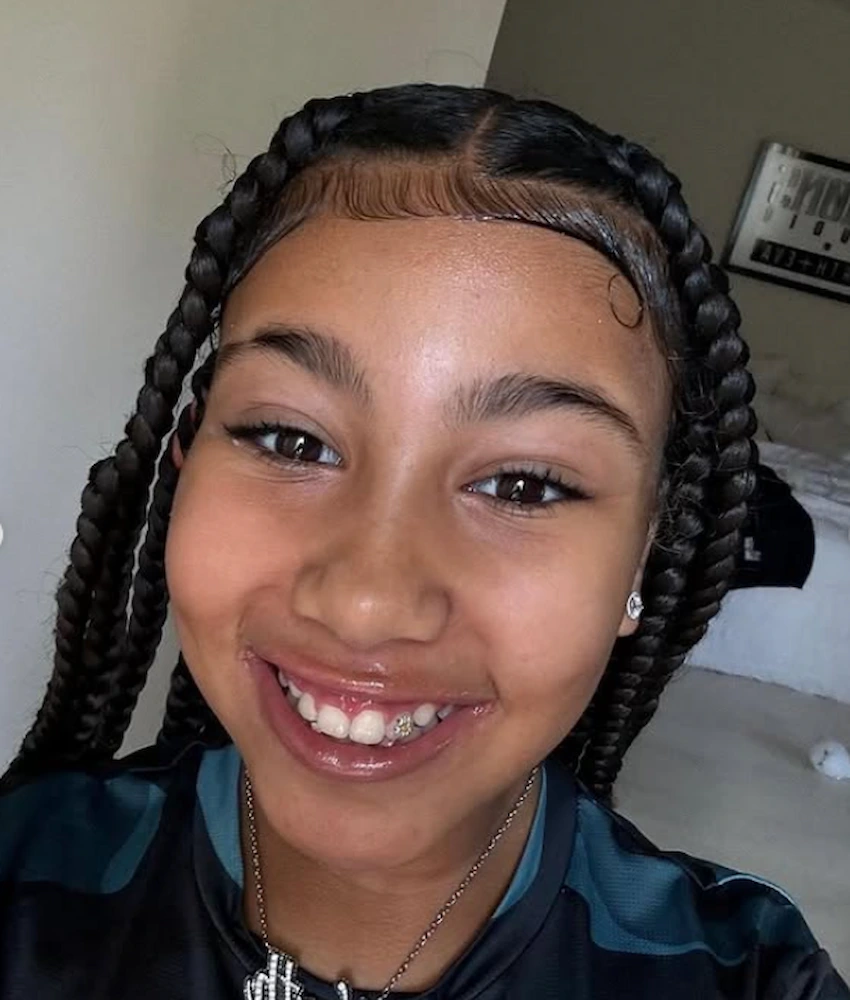north west teeth 2023