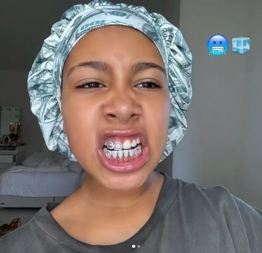 north west teeth 2025 1