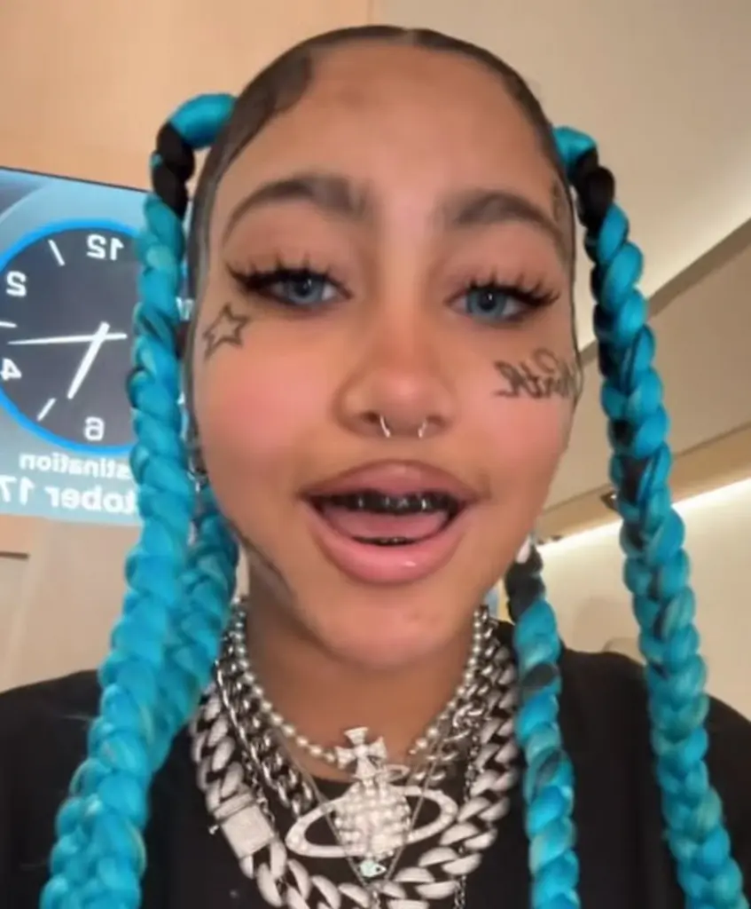 north west teeth 2025