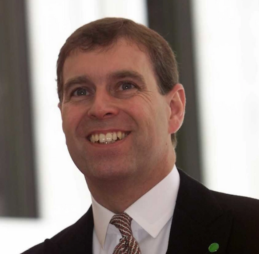 prince andrew teeth 2000