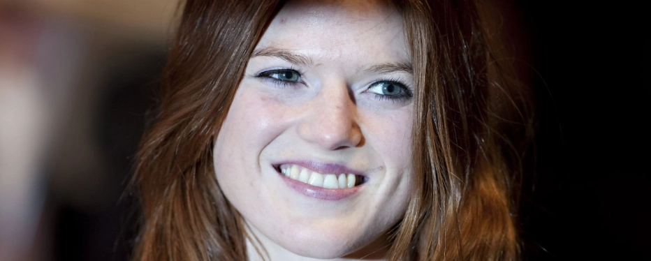 أسنان روز ليزلي في عام 2010