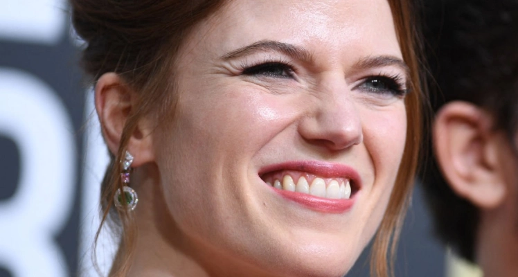 أسنان روز ليزلي في عام 2020