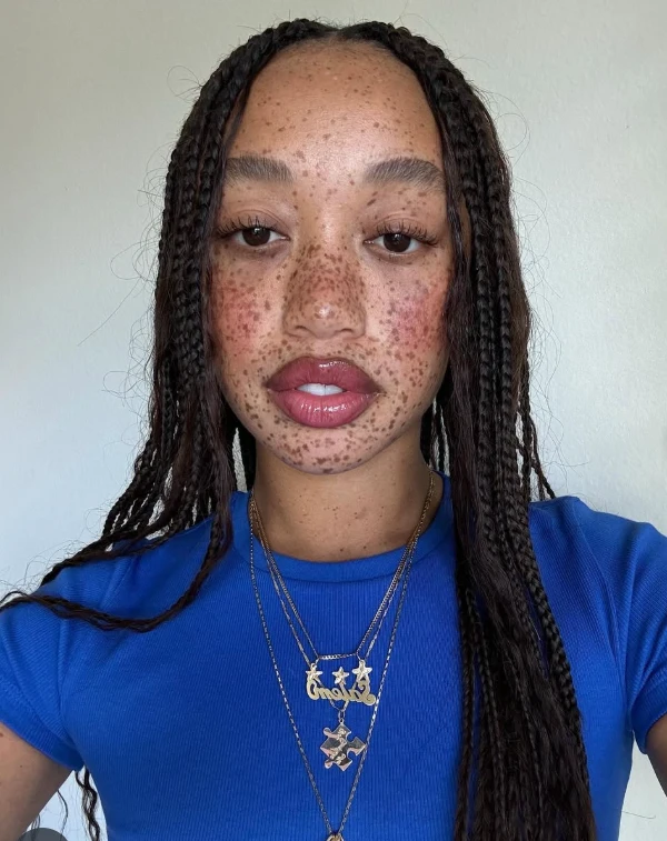 salem mitchell teeth in 2024