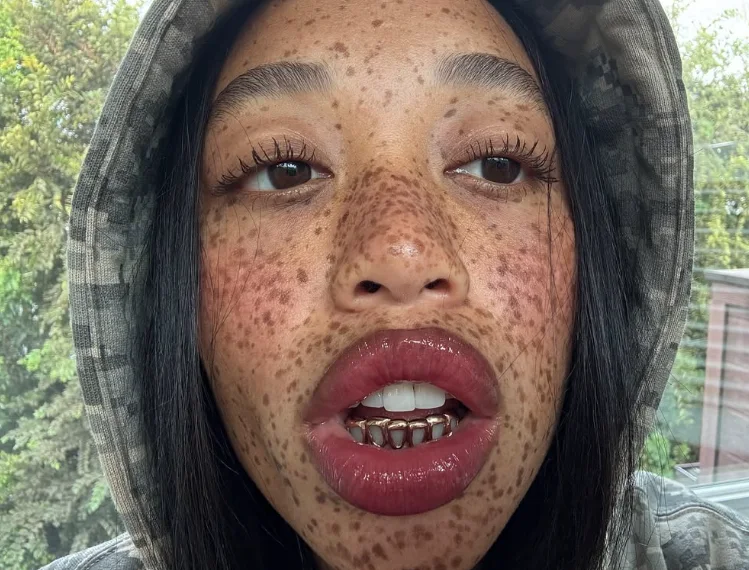 salem mitchell teeth in 2025
