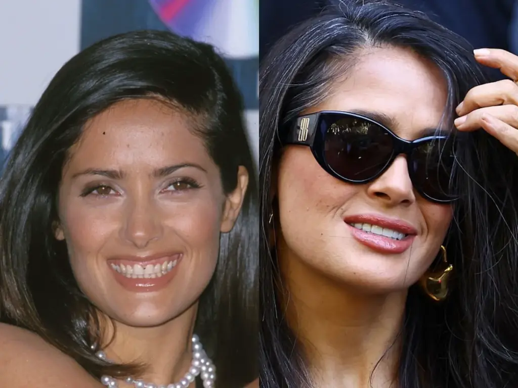 salma hayek teeth before after