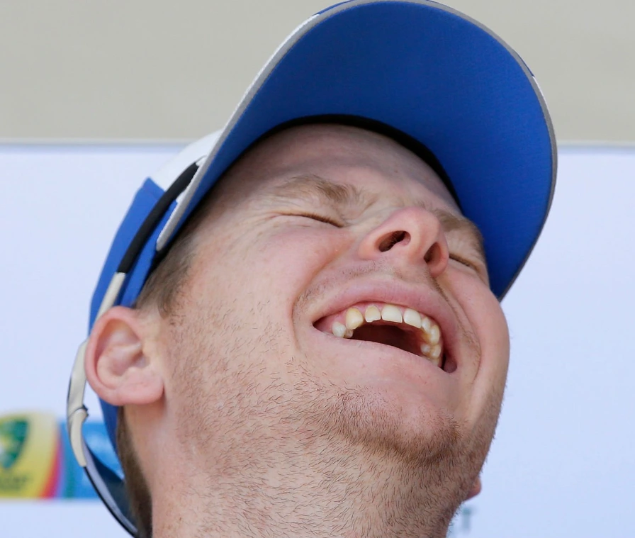 steve smith teeth in 2017