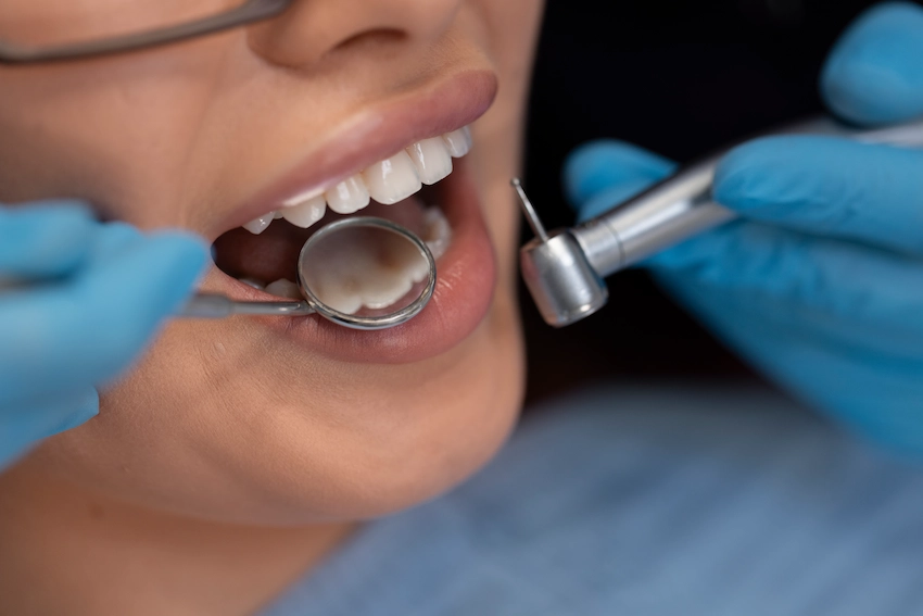 d3330-root-canal-treatment-dental-code