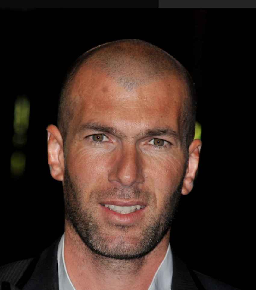 zinedine zidane tanden 2010